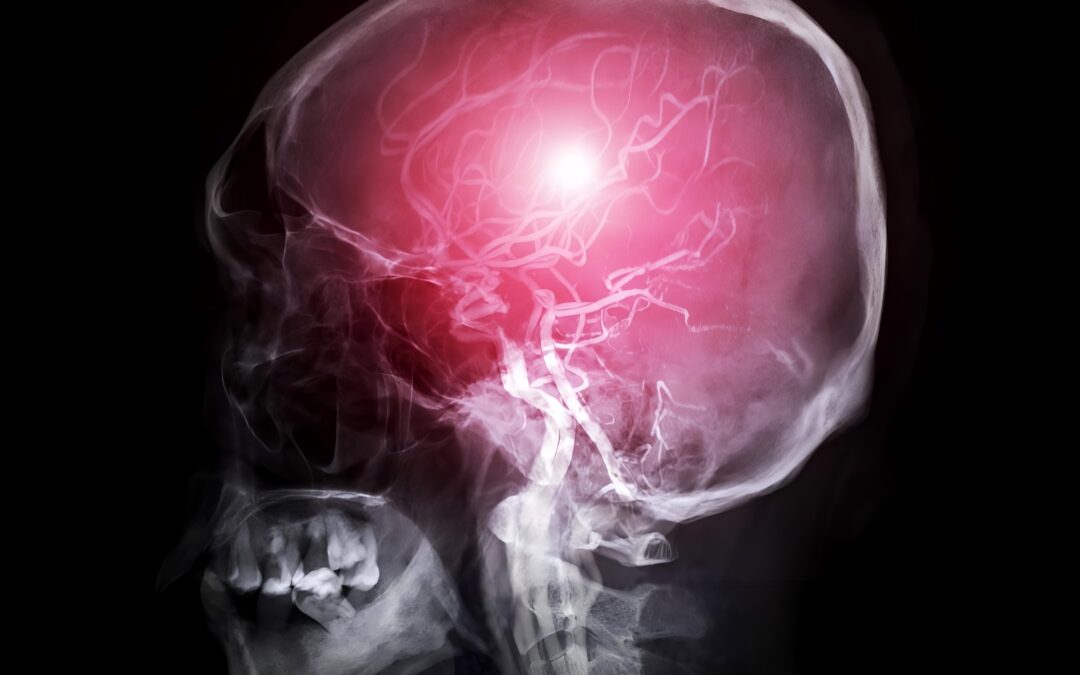 Massaging the neck and face helps flush waste out of the brain and may help fight Alzheimer’s