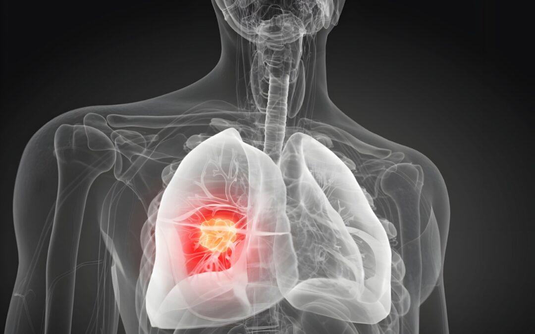Study shows air pollution is and rewriting our DNA causing cancer mutations