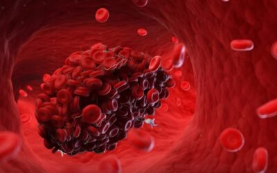 Study shows fasting reduces heart attack risk by preventing dangerous blood clots.