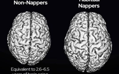Study finds people who nap regularly may have larger brains