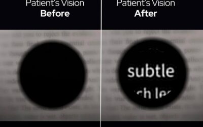 Stanford’s tiny eye chip helps the blind see again using infrared light