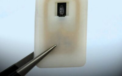 A tiny implant could stop diabetic comas before they even start