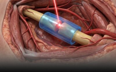 New light-activated polymer repairs nerves without stitches – and it was just approved by the FDA